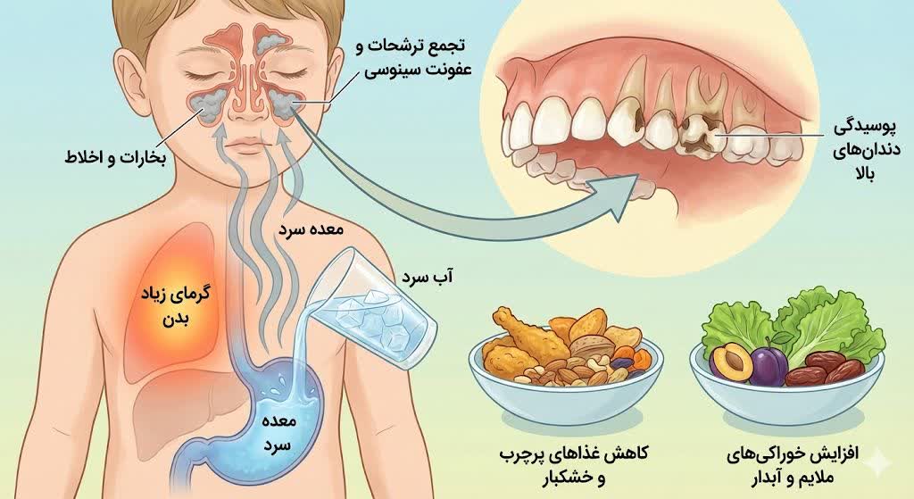 بررسی ارتباط مشکلات سینوسی با پوسیدگی دندان در کودکان